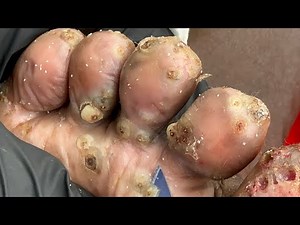 Buda’s part B of the right foot - watch the latest juiciest jigger videos @riseupsociety.net