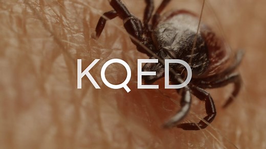 Why can't you just flick a tick? Because it attaches to you with a mouth covered in hooks, while it fattens up on your blood. For days. But don't worry – there *is* a way to pull it out. PSA: If you spend any time outside, ALWAYS CHECK FOR TICKS. | Deep Look • PBS