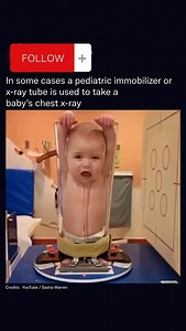 10K views · 284 reactions | When babies need chest X-rays within an...