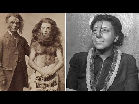 15 Circus Freaks You Won’t Believe Actually Exist!