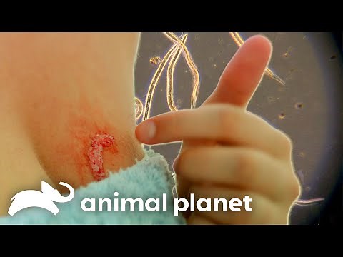 Parasitic, Bloodsucking Hookworm Crawling Under Woman's Skin | Monsters Inside Me | Animal Planet