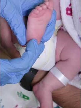 ARISE Newborn Babinski Reflex - Newborn Nursing Level 1 - 728