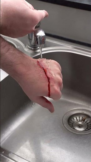 First Aid For A Cut Wound