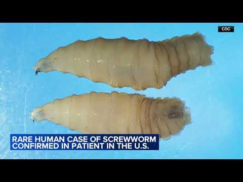 Rare human case of screwworm confirmed in patient in the US