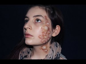 CATCHING FIRE FOG BLISTERS TUTORIAL | MOOREGORE