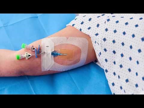 Tegaderm™ CHG (1658) - Application for PICC Video
