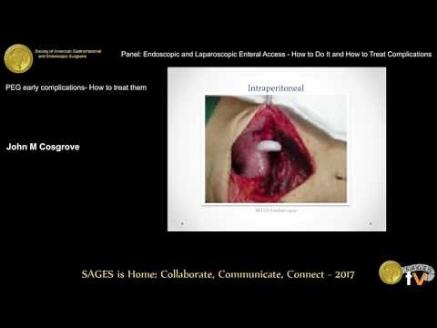 PEG early complications: How to treat them