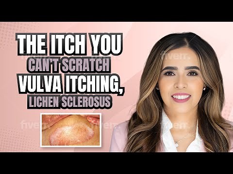 The Itch You Can’t Scratch. Vulvar Itching, Lichen Sclerosus