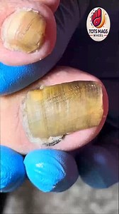 17K views · 122 reactions | Gentle toenail care routines that guide senior calmness 殺 #agingwell #feetfirst #dailywellness | Tots Mags Wheel | Facebook