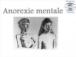 Anorexie mentale et les maladies secondaires à la dénutrition