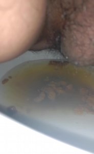 Milk diarrhea attack