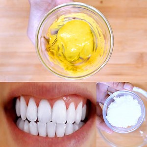 37 reactions · 3 comments | how to white your teeth || Natural Ways to Whiten Teeth at Home | Post Beauty Tips | Facebook