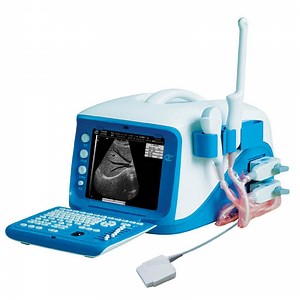 [Hot Item] Wt-6000 Full Digital Portable Color Doppler Ultrasound Scanner