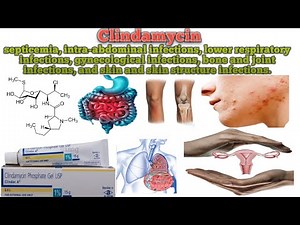 Clindamycin || Uses || How Clindamycin works ||Common side effects of Clindamycin
