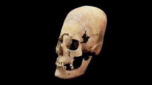 Genomic Analysis of Elongated Skulls Reveals New Insights