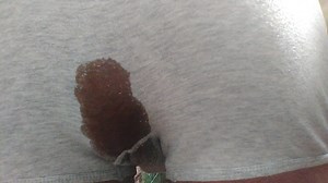 Diarrhea in pants #3
