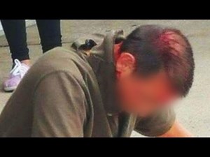 Pistol-whipped cop: I hesitated to shoot