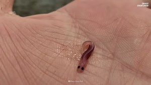 Watch what happens when a candiru enters the human body