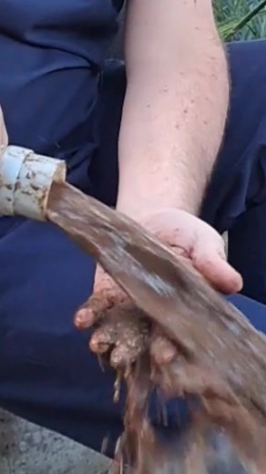 Understanding Cleanse Options: The Role of Enemas