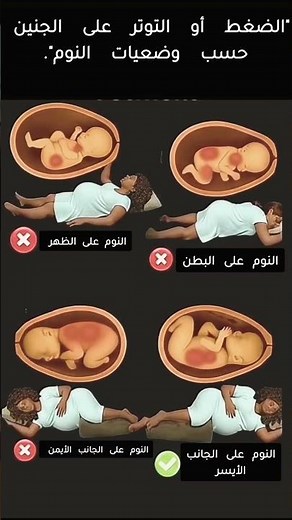 الضغط أو التوتر على الجنين حسب وضعيات النوم