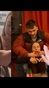 How To FIX A Dislocated Jaw!