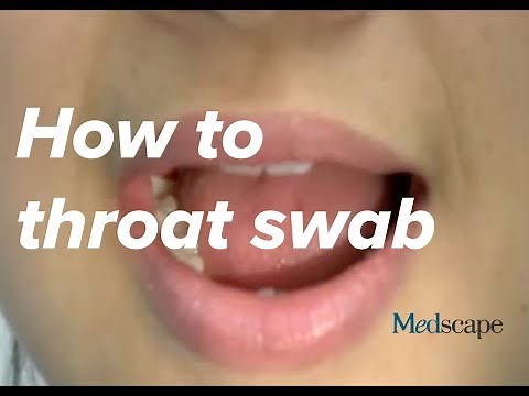 How to perform a throat swab on a patient