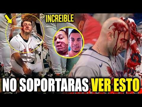 The Most DANGEROUS and Terrifying MLB Accidents That Will Give You CHILLS 3