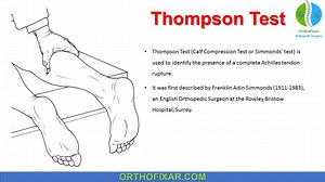 Thompson Test • Easy Explained | OrthoFixar 2026