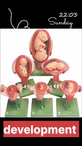 32 weeks baby position during pregnancy 💞 #shorts #viral | Chandan Kumar Chandu