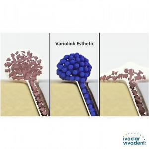 Variolink Esthetic Flexible ofrece un fácil manejo, combina perfectamente las propiedades de fluidez y alta estabilidad, fotopolimerizable y consistencia situacional flexible. ¿Quieres conocer más ? Dale clik al video | Ivoclar