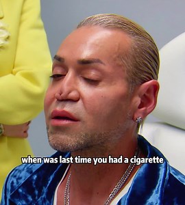 #fyp #tk #usa #foryou #botched | robert botch makeup result now