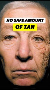 Are you making this mistake ⬇️AVOIDING FULL SPECTRUM LIGHT ☀️ I used to be afraid of the sun and a quick google search would corroborate my fear! “YOU MUST AVOID SUNLIGHT FROM 10am-3pm OR YOU RUN THE RISK LF SKIN CANCER!” - Average DermatologistBut here’s the truth:✅ Natural Light maybe the BIGGEST nutrient deficiency of our age!Recent studies have shown we spend up to 90% of our day inside, behind windows and under artificial light environments 💡 This has thrown off our circadian balance and i
