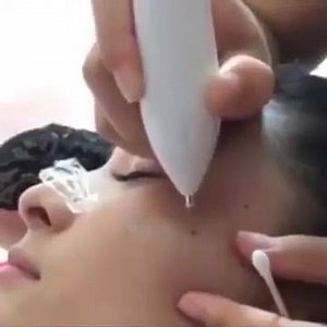 It's easy to remove those pesky moles on your face or body with this mole remover! 50% OFF with FREE Shipping! It will not hurt the normal skin, just tap the mole with the tip and wipe. Its like magic! https://gottahaveitcatalog.com/products/beauty-instrument-laser-freckle-removal-machine-skin-mole-removal-dark-spot-remover-for-face-wart-tag-tattoo-remaval-pen-salon | Mrs. Bitch Quotes