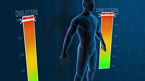 3D Animation and illustration of lowering cholesterol levels from very high to normal