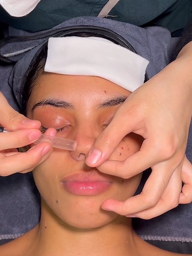 Relaxing Vietnamese Vacuum Facial Massage ASMR