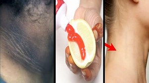 how to get rid of a dark neck is a natural and easy brown skin treatment around the neck! | Pure Beauty Tips