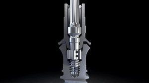 Torcfit Connection! Designed to optimize the restorative workflow. Straumann TLX now available! Contact your local rep for details about Straumann TLX! #straumann #tlx #immediexy | Straumann | Facebook