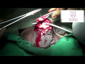 Total Orchiectomy final