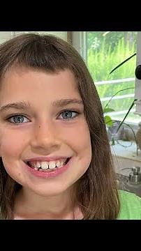 How to cut potatoes safely (knife skills with Shoshanna)￼