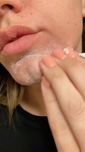 15 reactions · 6 comments | Unleash your skin's radiance with our Dermatologist recommended Microdermabrasion Scrub! 朗朗 This scrub is formulated with Jojoba Seed Oil for deep moisturization and dead sea salt for gentle exfoliation. Diminish acne scars, fine lines, and wrinkles leaving skin soft and radiant. | DERMA E | Facebook