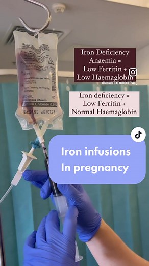 IRON INFUSIONS 🤎 Iron is a component that makes up the red blood cells in the body, which are responsible for carrying oxygen around the body. ⭐️ Iron deficiency is low ferritin but normal haemoglobin levels. ⭐️ Iron deficiency anaemia is low ferritin AND low haemoglobin. If you have exhausted the oral iron medications and iron rich foods prescribed by your obstetrician or midwife and levels are not improving, they may offer an iron infusion. It is not a blood product but a dark brown solution 