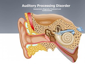 Auditory Processing Disorder - SlideServe