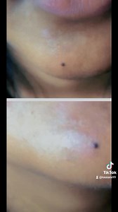 12K views · 39 reactions | Birthmark tattoos ❤鹿 . . . . . . . ....