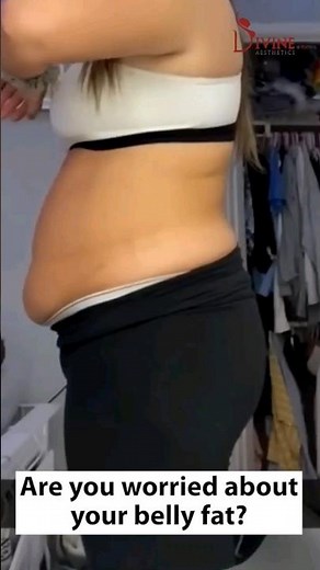 Belly Fat Surgery Result | Abdominal Liposuction Before and After #youtubeshorts