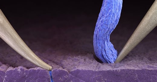 Stanford scientists figured out why lithium metal batteries fail