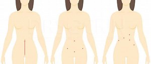 The Surgery Techniques we Use for Endometriosis