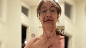 Freezer-rummaging bear attacks woman in home