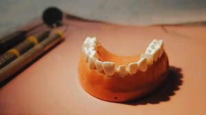 Dental Aesthetic video presentation teaser Topic : Cad Cam #dentaltechnology | John Ryan Magalona