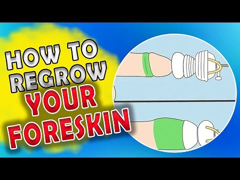 Foreskin Restoration: How to Regrow your Foreskin