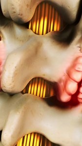 128K views · 367 reactions | Look into how facet joint arthritis can lead to spinal cord compression—and what you can do about it. Learn the warning signs like neck stiffness, pain, and tingling, plus expert-backed treatments to find relief! 領易 #FacetJointArthritis #SpinalCordCompression #NeckPainRelief #ArthritisAwareness #SpineHealth #ChronicPain ‍♂️ | Spine-health | Facebook